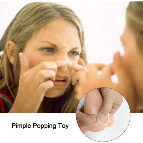 Pimple Popping Toy Acne Squeeze Toys Pressure Relief Prank Stress Reliever Toy Novelty & Gag Toys For Children Adult 2021 New