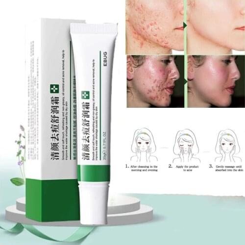 Effective Acne Removal Cream Acne Treatment Fade Acne Spots Oil Control Shrink Pores Whitening Moisturizing Acne Cream Skin Care
