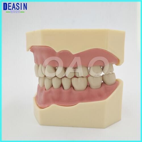 Dental Soft Gum Teeth Model Removable 28pc Teeth NISSIN 200 KAVO head model Compatible
