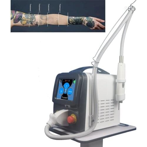 PICOTECH picosecond laser 755 q switched nd yag laser tattoo removal carbon peeling machine