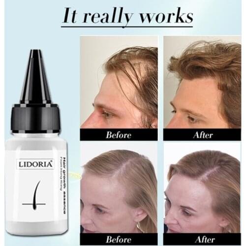 20ml Fast Hair Growth Serum Anti Preventing Hair Lose Liquid Damaged Hair Repair Treatment Eyelash Eyebrow Growing Thick Care