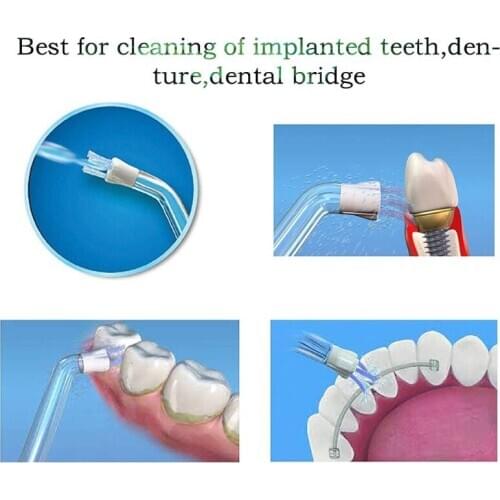 1PCS Plaque Seeker Tip for Waterpik Water Flosser Replacement Random Color L69D