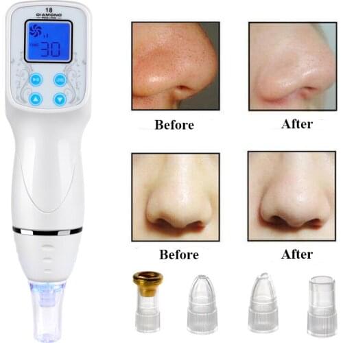 Blackhead Removal Vacuum Suction Diamond Microdermabrasion Skin Peeling Scar Acne Removal Diamond Dermabrasion Facial Massage