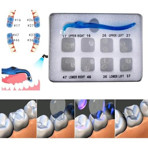 Dental Orthodontic Posterior Teeth Aesthetic Printing Kit Printing Restoration Teeth Quick Built Dentistry tools Material