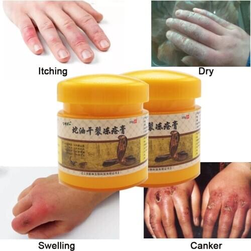 Chinese Medicinal Ointment Hand Foot Crack Cream Heel Chapped Peeling Repair Frostbite Anti Dry Crack Skin Creams Wholesale