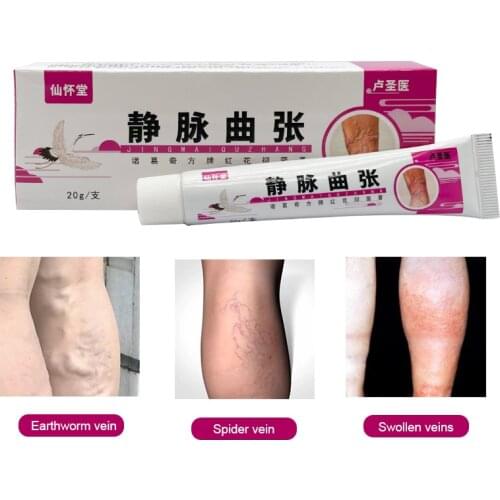 Varicose Veins Cream Treatment Vasculitis Phlebitis Ointment Relief Pain Plaster Removal Angiitis Chinese Medical Personal Care