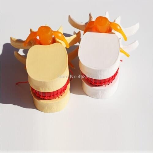 1:1.5Human Anatomical Lumbar Disc lumbar enlarged Herniation Model Medical teaching Aid Anatomy Instrume
