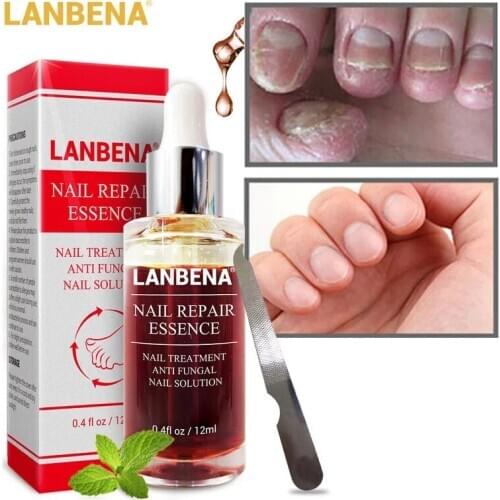 LANBENA Nail Repair Essence Serum Fungus Removal Gel Anti Infection Paronychia Onychomycosis Hand Foot Nails Treatment Skin Care