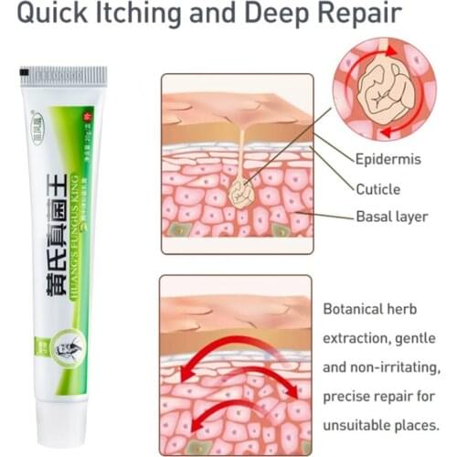 Athletes Foot Cream Erosive Beriberi Anti-Itch Sweat Odor Feet Psoriasis Pain Patch Antibacterial Ointment Foot Care 20g