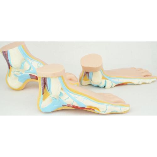 Normal Human Foot Platypodia Bow Foot Anatomy Model Muscle Vascular Teaching 1:1