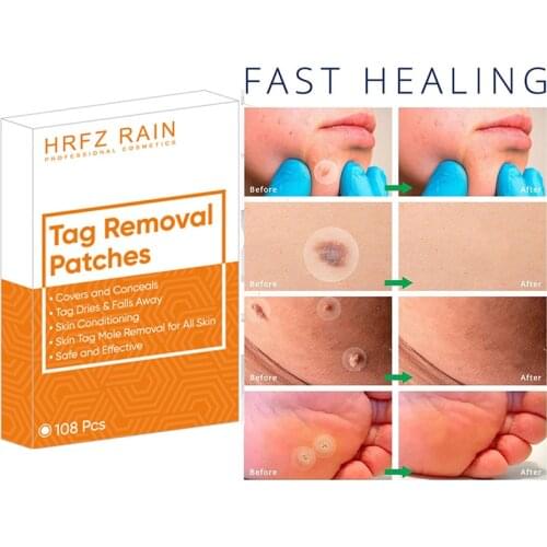 108pcs Skin Tag Remover Acne Patch Wart Removal Patch Invisible Patch Stickers Remove Acne Cutaneous Skin Tags Relief Skin Care