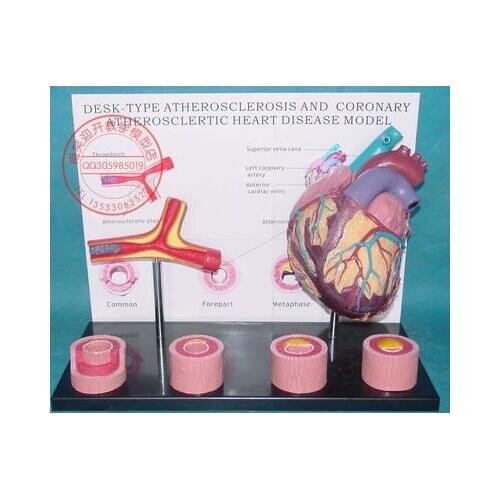 Atherosclerosis heart disease Anatomical Model free shipping