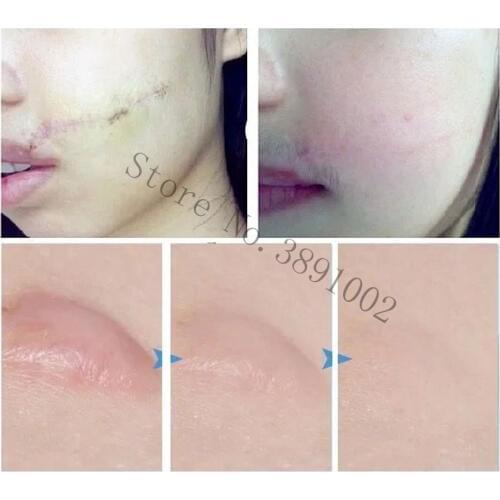 Okeny's Face Emulsions