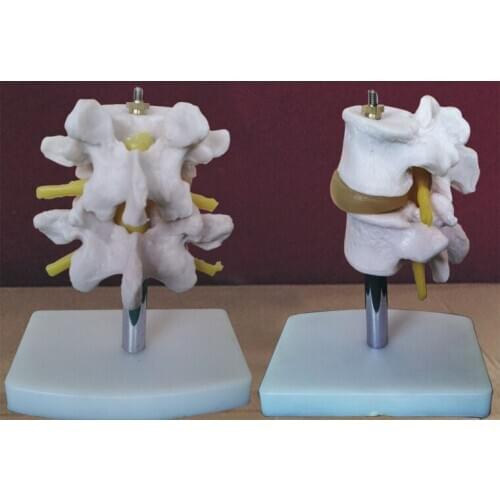Natural size PVC material Two section lumbar spine skeleton model with stand