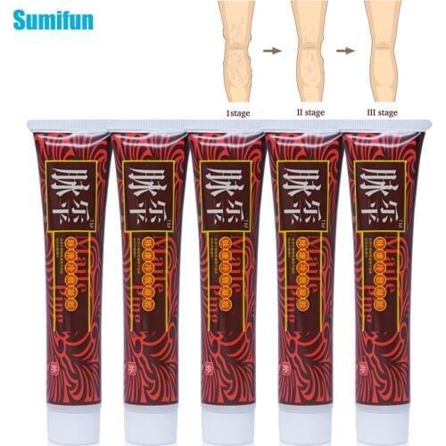 SMF 5Pcs Varicose Veins Treatment Ointment Varicosity Angiitis Removal Medical Plaster Vasculitis Phlebitis Spider Cream