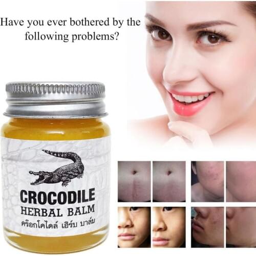 Crocodile Scar Removal Cream Thailand Herbal Balm Whitening Face Cream Stretch Marks Acne Scar Remover Pigmentation Corrector