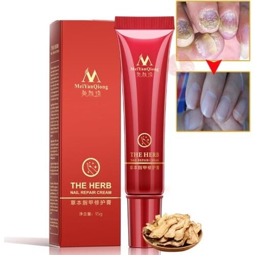 Chinese Herbal Toe Nail Fungus Herb Nail repair cream for Onychomycosis Paronychia Anti Fungal Nail Infection