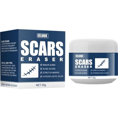 30g Acne Scar Stretch Marks Remover Cream Skin Repair Face Cream Acne Spots Acne Treatment Scar Gel Skin Care
