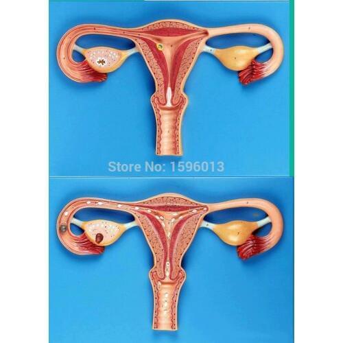 Fertilization Process Simulator model, Egg fertilization process model