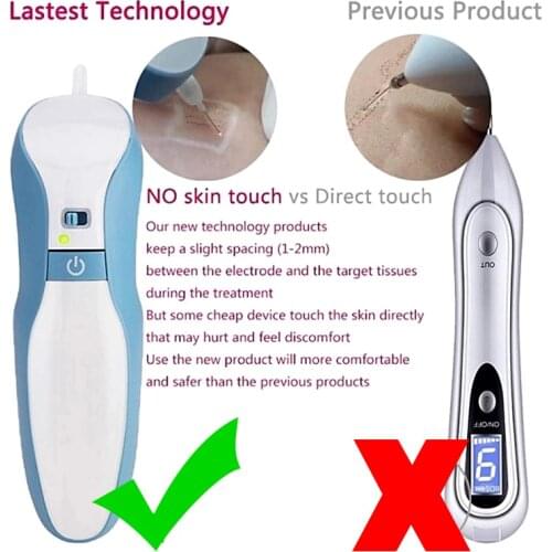 Eyelid lifting Pen Maglev Plasma Pen Laser Plasma Tattoo Freckle Dark Spot Remover Wart Removal Beauty Machine Removal pen