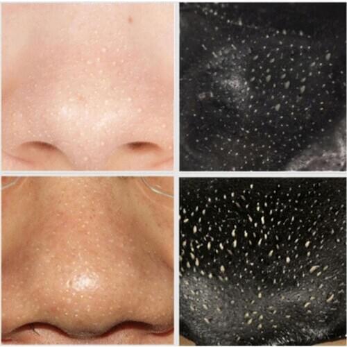 Black Head Mask Volcanic Mud Dead Skin Remove Shrink Nose Acne Spot Suck Pull Black Film Mask Dropshiping Head Type Pores S7L8