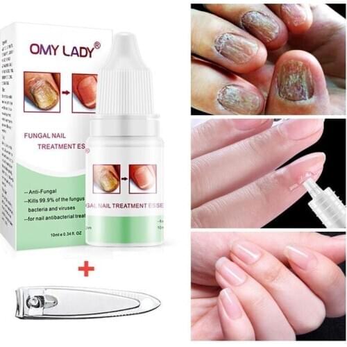 10(g/ml) Nail Repair Solution Nail Protector Skin Care Cream Nail Fungus Treatment Nails Repairing Cream Nail Care Tools