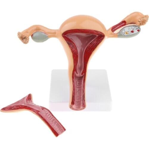 Medical Props Human Pathological Uterus Ovary Model Anatomical Anatomy Disease Pathology Medical Lesion Teaching Learning Supply