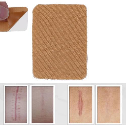 New Silicone Removal Patch Reusable Acne Gel Scar Therapy Silicon Patch Remove Trauma Burn Sheet Skin Repair
