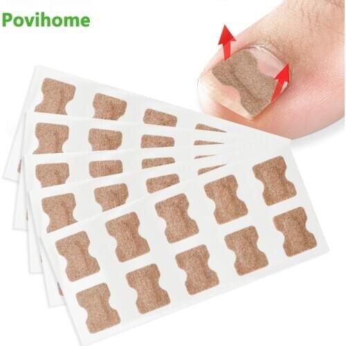 20pcs Ingrown Toenail Correction Patches Orthodontic Plaster Pedicure Paronychia Recover Inflammatory Toenail Orthotic Patch