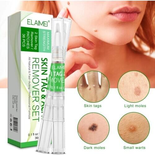 Skin Tag Cure Removal Body Mole Wart Remover Spot Marks Wart Remover Serum Skin Care TSLM1