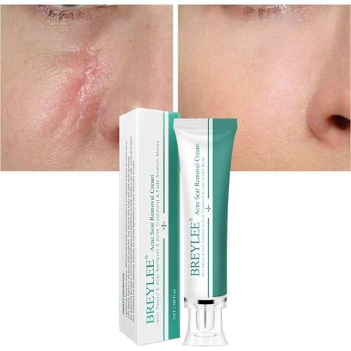 Scar Gel Cream Bruises Stretch Treatment 30g Skin Care Old & New Scars