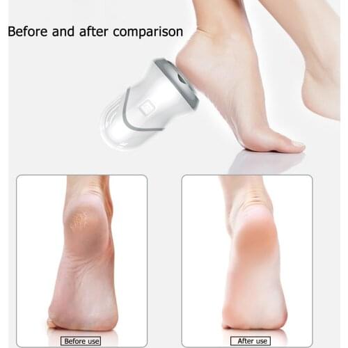 Foot Grinder Remover Hard Cracked Skin Files Vacuum Dead Skin Callus Electric for Personal Foot Healthy Protection Part
