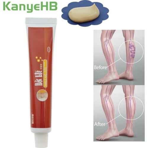 1pcs Vasculitis Phlebitis Spider Cream Treating Varicose Vascular Inflammation Massage Cream Cure Varicose Vein Ointment S034