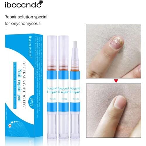 3ml Nail Repair Pen for Onychomycosis Paronychia Anti Fungal Nail Infection Nails Care Treatment Health