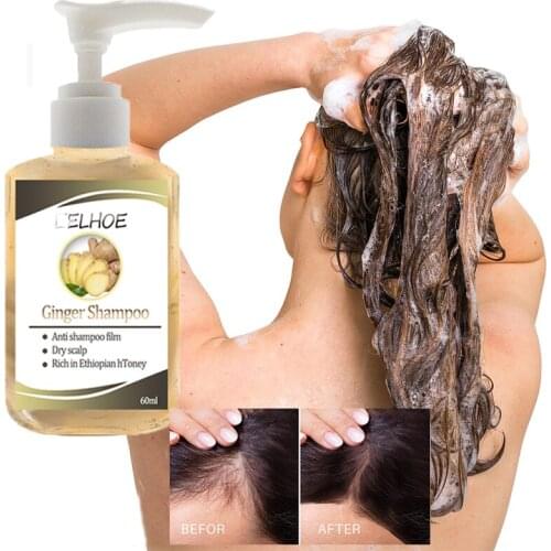 Ginseng Anti-Hair Loss Shampoo Powerful Treatment Essence Herbs Ginger Cooler Hair Growth Lotions For Men Women