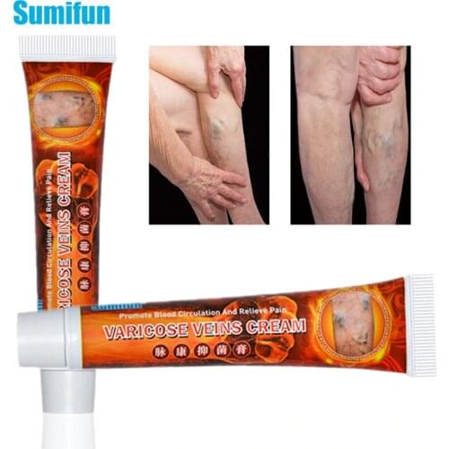 1pcs New Varicose Veins Cream Vasculitis Phlebitis Spider Pain Relieving Patch Varicosity Angiitis Treatment Herbal Ointment