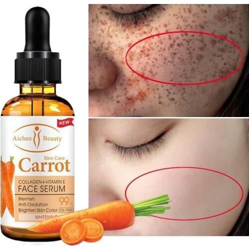 Dark Spot Corrector Whitening Serum Face Bleaching Serum Brighten Blemish Freckle Remover Natural Carrot Essence Korea Skin Care