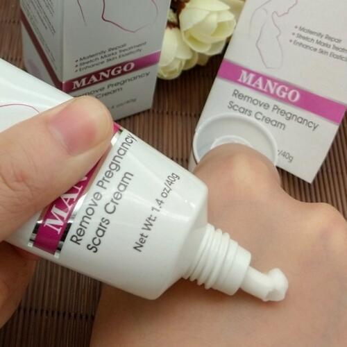 Stretch Mark Repair Cream Pregnancy Scars Removal Body Skin Care for Pregnant SSwell
