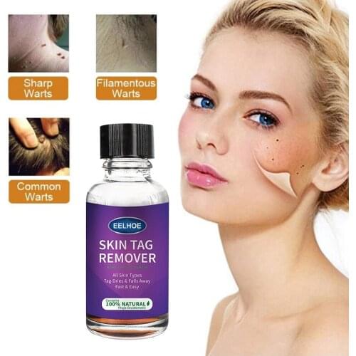 1030ml Skin Tag Removal Remover Warts Removal Relief Medical Treatment Meat Corn Skin Flat Wart Antibacterial Liquid