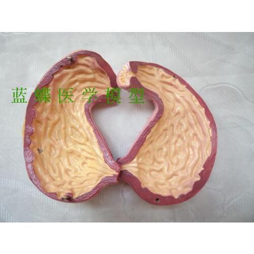 Stomach and profile model, stomach anatomy model, stomach model, stomach structure model