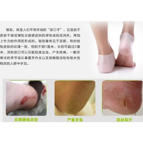 Foot care series Silicone heel cover pad podoschisis protective jacket as wearproof heel crack prevention mat relieve heel pain