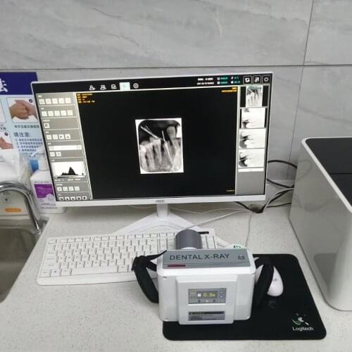 Dental Phosphor Image Plate Scanner Intraoral Phosphor Screen Scanner