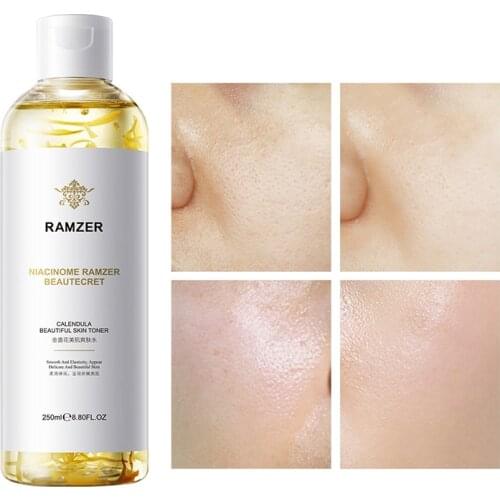 Calendula Beautiful Skin Toner Moisturizing Improve Dry Face Essence Sooth Sensitive Skin Oil-control Shrink Pores Facial Toner