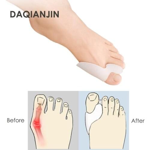 1 Pair Silicone Big Toe Separators Are Suitable For Bunion Valgus Correction Toe Overlap Adjustment Pain Relief Foot Care Tools