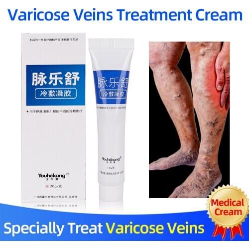 Varicose Vein Cold Compress Gel Ointment Treatment Phlebitis/Vasculitis/Varicosity Angiitis Pain/Swelling Relief Body Care Cream