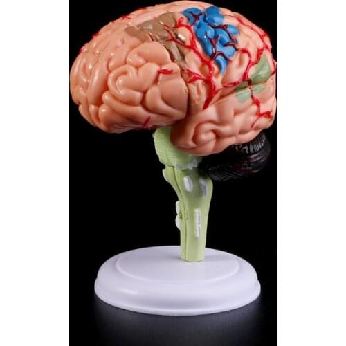 4D Disassembled Anatomical Human Brain Model Anatomy Medical Teaching Tool Statues Sculptures Medical School Use