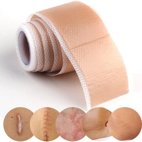 Silicone Gel Patch Removal Scar Stickers Medical Treatment Sheet Tape Efficient Surgery Cover Skin Repair Acne Trauma Burn Scar
