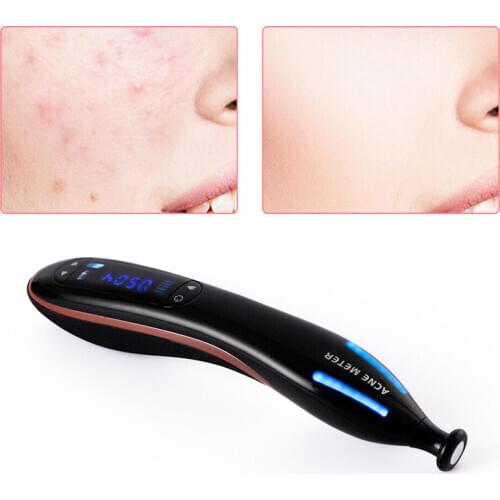 Plasma Pen Scar Acne Spot Removal Anti Wrinkle Aging Therapy Blue Light Acne Treatment Pen Beauty Device Face Skin Care Machine