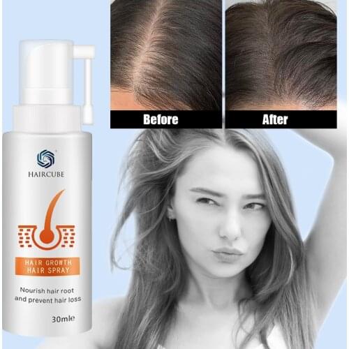 HAIRCUBE Stop Anti Hair Loss Fast Hair Growth Products For Men Woman Hair Growth Spray Essential Oil Liquid Essence Regeneration