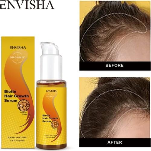 ENVISHA Hair Growth Oil Hair Care Serum Fast Growing Dense Nourishing Essence Hair Loss Products With Argan Castor Oil 50ML
